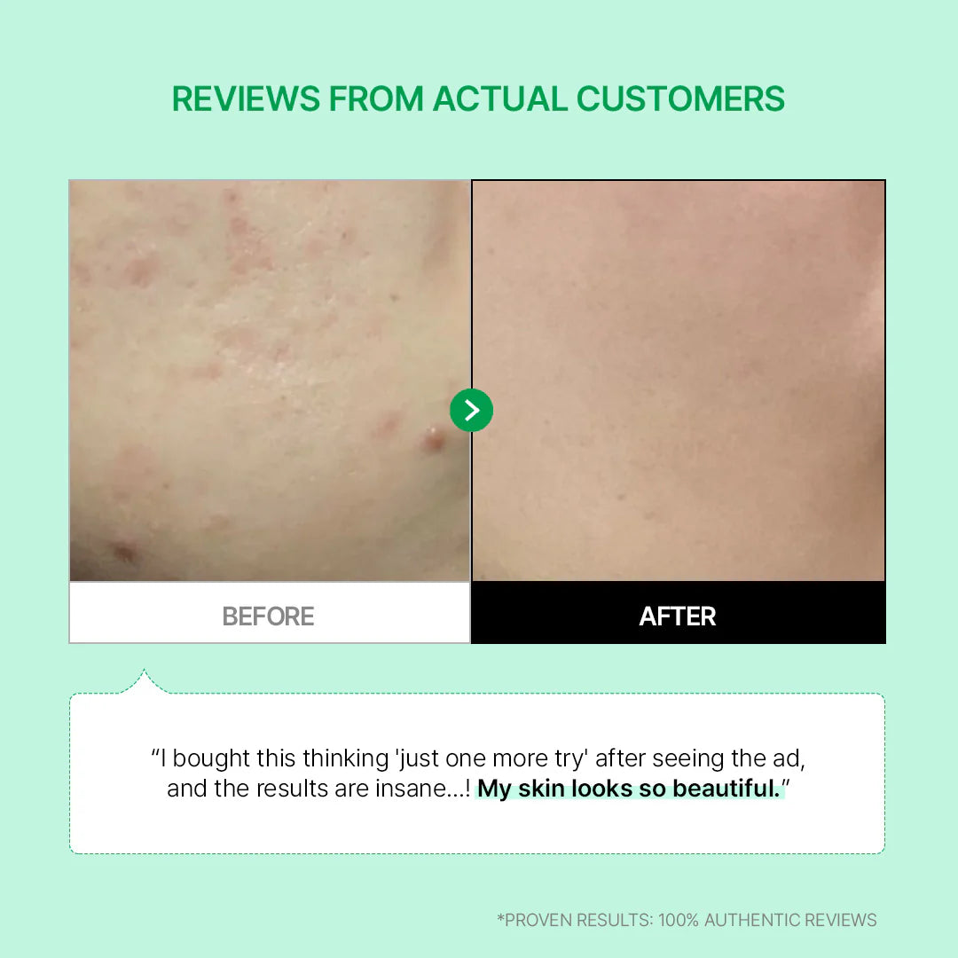 Cicamanu 92 Serum