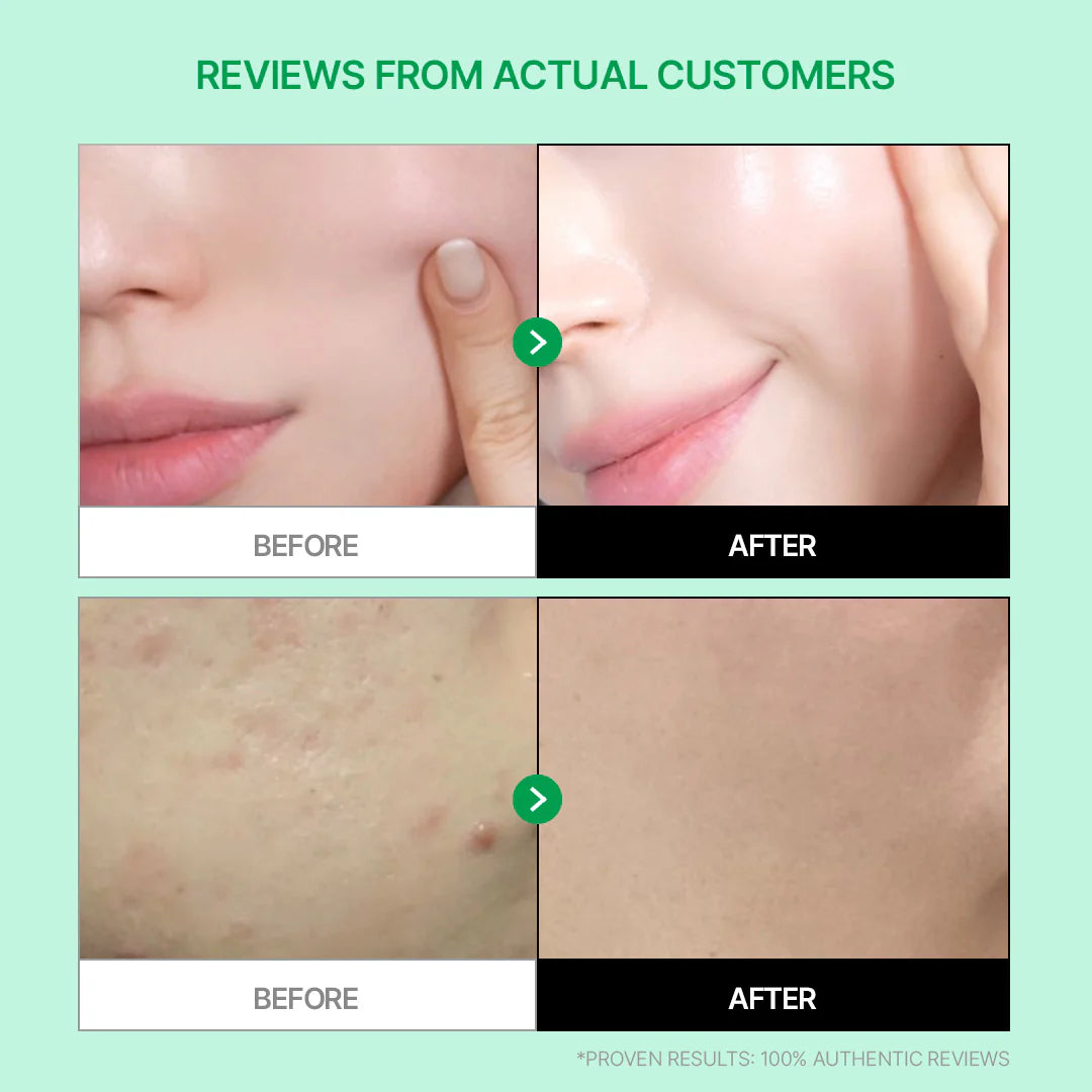 Cicamanu Serum Mist