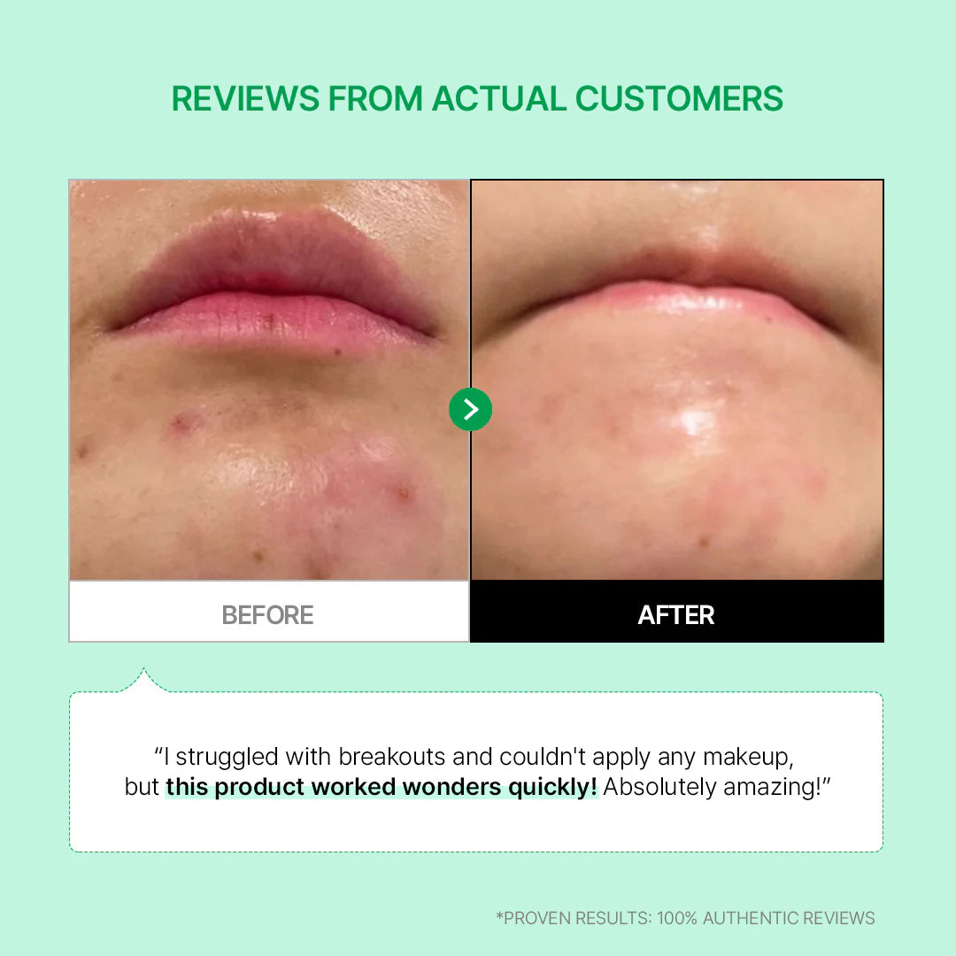 Cicamanu 92 Serum