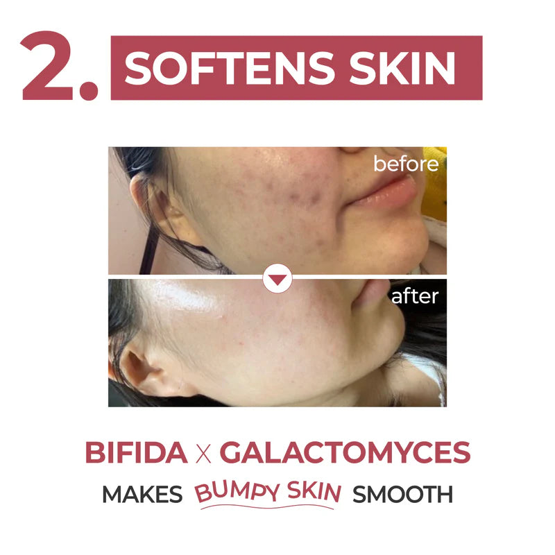 No.3 Skin Softening Serum