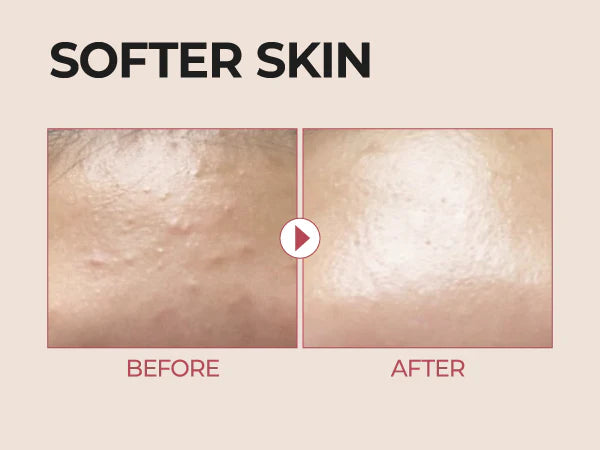 No.3 Skin Softening Serum