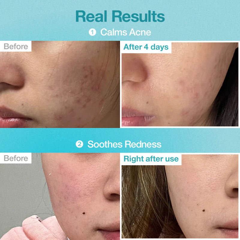 No.1 Pantothenic B5 Hyaluronic Active Clear Mask