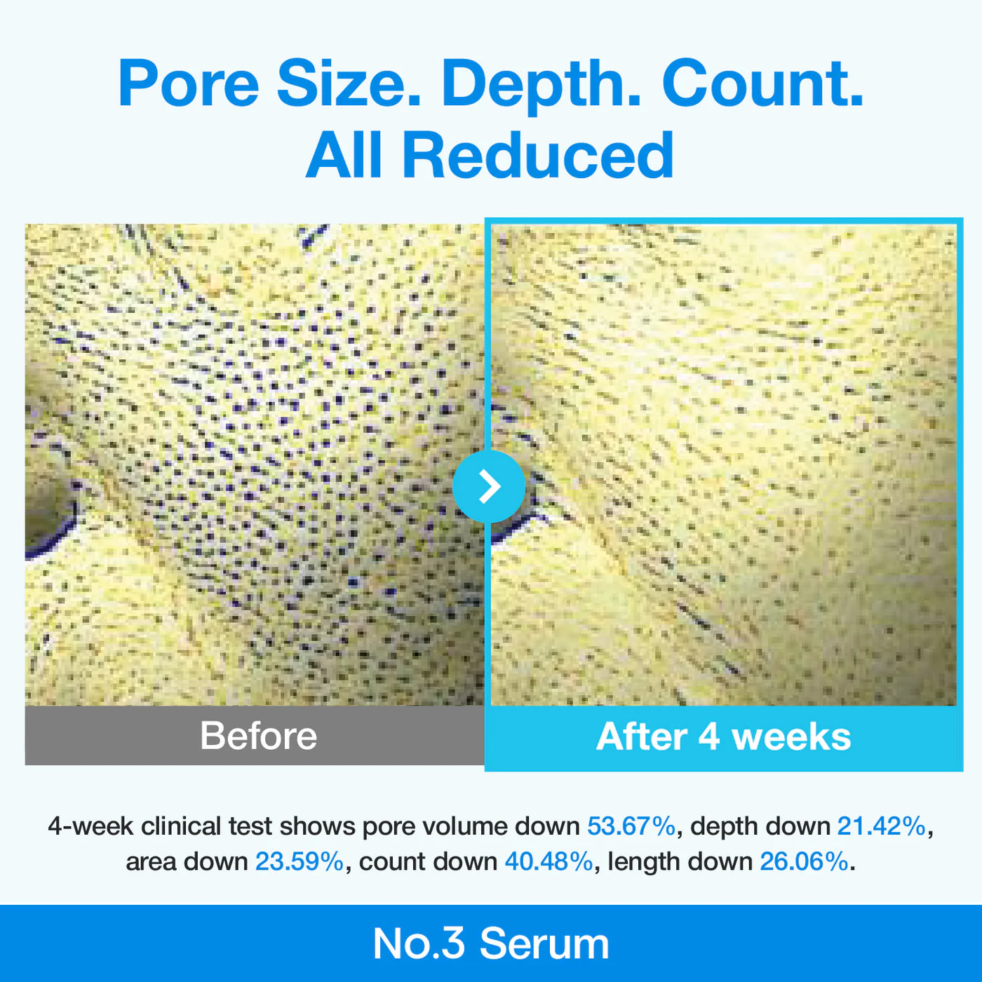 No.3 Blue Bio-Retinol Pore Refining Serum