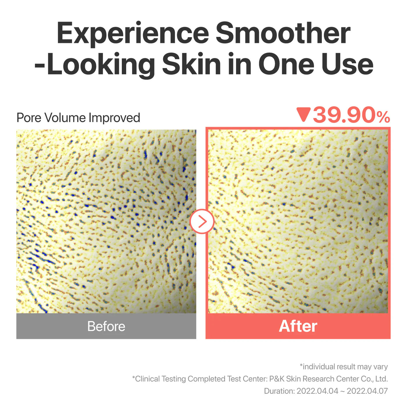 No.3 Tingle-Pore Softening Sheet Mask