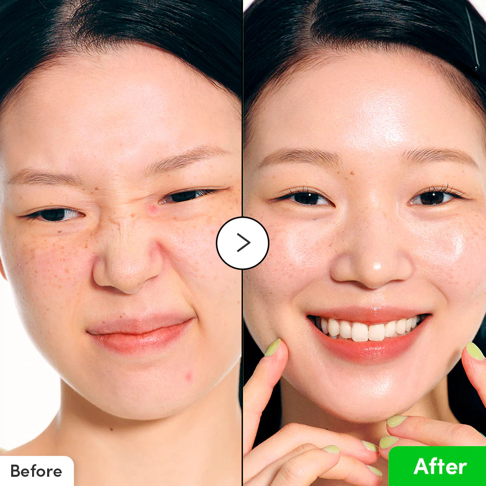 Aloe Pdrn Calming Serum